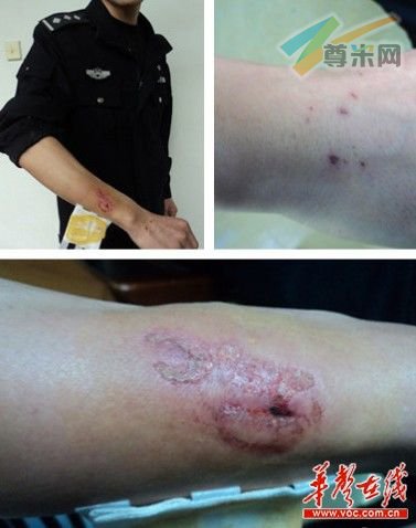 厦门市公安局思明分局称，强制将女孩押上车是因为其“动手殴打民警的胸、腹部，先后两次咬伤民警右手臂”。 网络截图